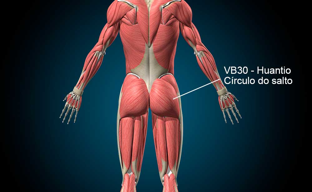 Ponto VB30 no meridiano da Vesícula Biliar.